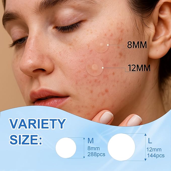 Amouy Acne Pimple Patch- 2 Sizes 432 Dots Thin & Thick Hydrocolloid Patches for Face with Witch Hazel, Tea Tree & Calendula Oil, Extra Adhesion Pimple Patches for Face Zit Patch Acne Dots