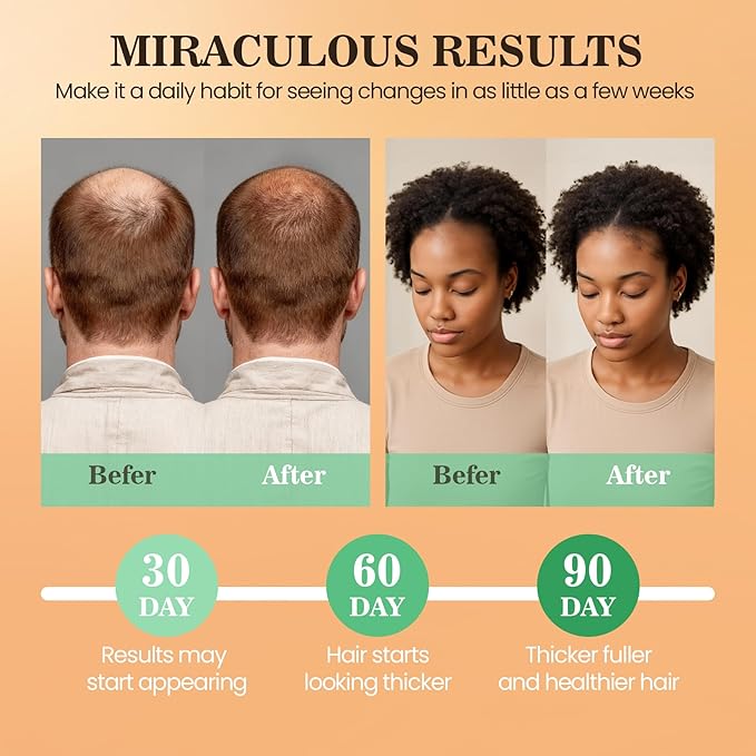 Batana Oil for Hair Growth Dr Sebi, 100% Raw Organic Batana Hair Mask from Honduras, Wild Growth Hair Oil, Scalp Oil Promotes Hair Thickness, Prevents Loss for Men & Women (4.06 Fl Oz, Nutmeg)