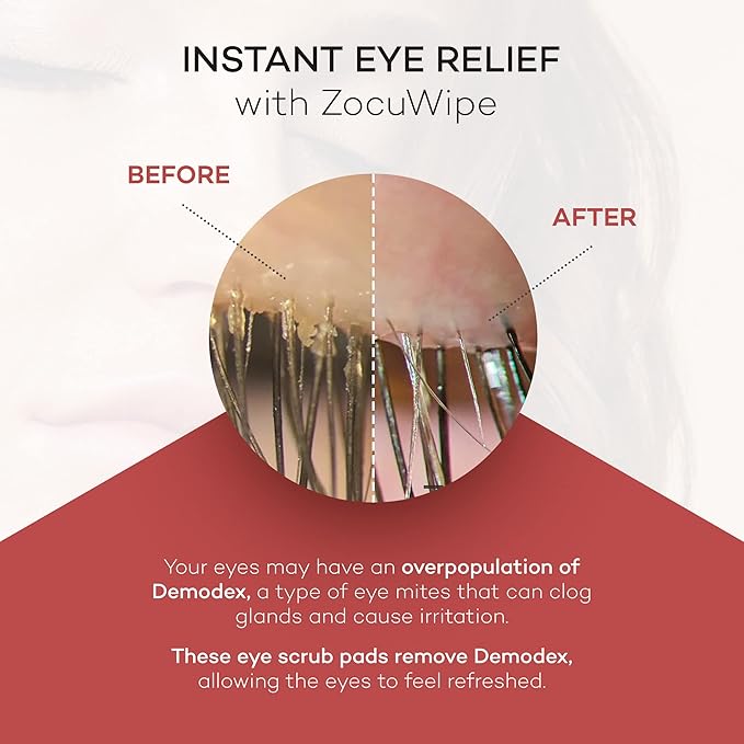 Zocular Zocuwipe Eyelid Wipes with Natural Okra Complex – Gentle Eyelid Cleansing & Moisturizing Pads – 40 Count