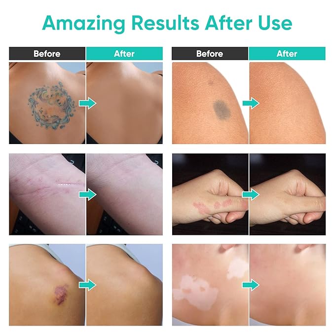 Tattoo Cover Up Makeup, 2 Colors Waterproof & Sweatproof Tattoo Cover Up Makeup, Long Lasting and Invisible Body Makeup Suitable for Vitiligo, Dark Spots, Scars-Natural