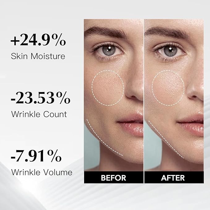 MORlTEK Deep Anti-Aging Mask (1pcs) - Firming V-Shaping Collagen and Provides intense Moisture for a Youthful Glow, Perfect for Targeted Repair and Rejuvenation