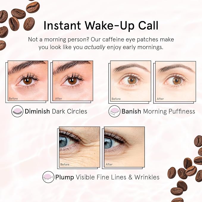 grace & stella Caffeine Under Eye Patches - Awakening Eye Patches for Puffy Eyes and Dark Circles, Under Eye Mask Patches with Niacinamide & Hyaluronic Acid - Teen Girl Gifts, Vegan (Bronze, 24 Pairs)