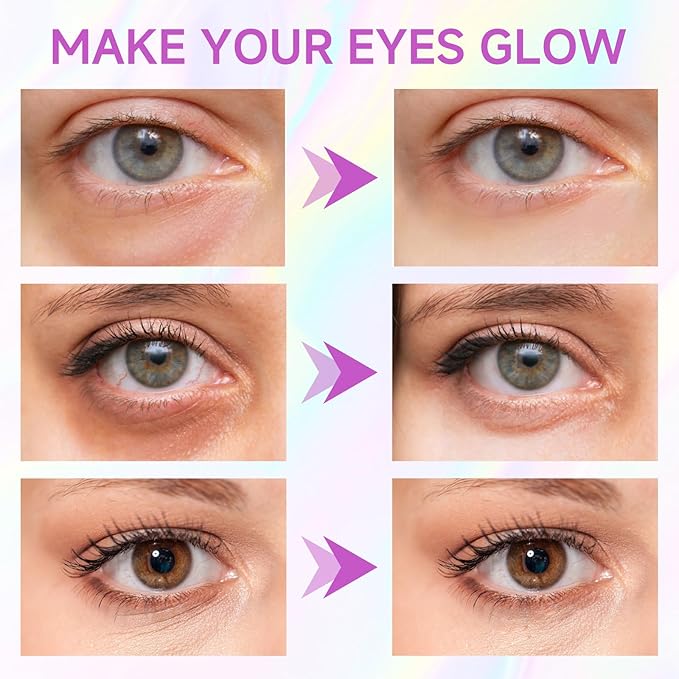 CEMSAZORL Instant Firm Under Eye Patches, Collagen Peptide Firming Under Eye Mask for Puffy Eyes and Dark Circles Treatment, Wrinkles Filler Improve Fine Lines Skin Care for Women Men, 10 pair