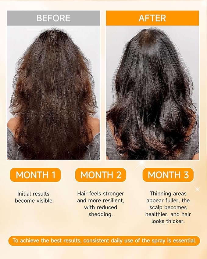 Hair Growth Spray, Hair Growth Oil Spray, with Biota Orientalis, Rosemary Oil & Biotin, Strengthens Hair Roots, Prevent Hair Thinning & Loss, Thicker Fuller Hair for Women & Men (3 pack, 3% Rosemary)