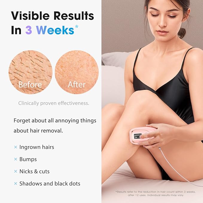 IPL Laser Hair Removal Device for Women & Men - Home 45°F Ice-Cooling Contact for Painless & Long-Lasting Results, 86% Hair Reduction in 3 Weeks for Full Body & Bikini Line, Light Pink