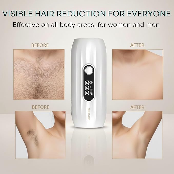 FrostLite Pro Ice Cooling IPL Home Use Hair Removal Device- Gentle & Painless Hair Reduction for Smooth, Hair-Free Skin on Body and Face for Women and Men