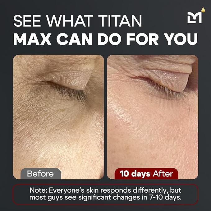 Man Labs Titan MAX Anti-Aging Face Serum for Men – Ultra Potency Mens Face Moisturizer – Men, Dark Spots, Wrinkles, Fine Lines – Vitamin C & E, 10% Niacinamide, Hyaluronic Acid – Unscented