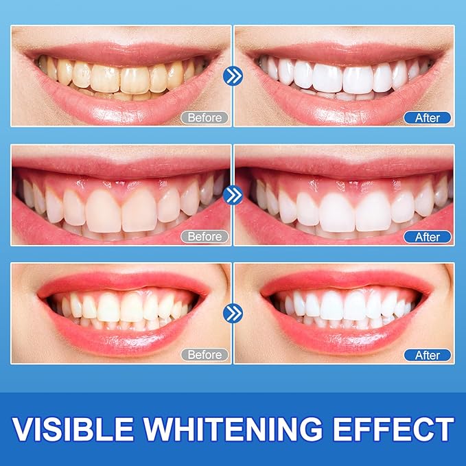 Sensitive Teeth Whitening Strips Kit - 28 Strips Whitener Safe Whitestrip,14 Treatments Sodium Hydroxide Teeth Whitener for Coffee, Wine, Tobacco, and Other Stains