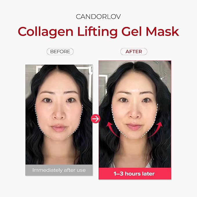 CANDORLOV CDL Korean Collagen Duo - Collagen Hydrogel Face Lifting Mask (5 Sheets) + Collagen Hydrating Glass Glow Cream - Anti-Aging, Firming & Plumping with OLIGO-HA Phyto-PDRN