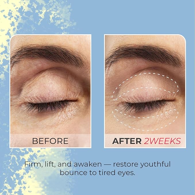 KSBC Look At Me Teen Again Roll-On Firming Eye Cream, Anti-Aging Line Smoothing Skin Care Treatment, Wrinkle Care, Cruelty Free, for Women and Men 0.54 fl. oz, 16ml