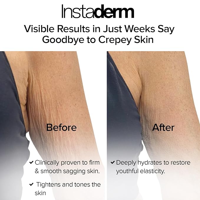 Crepe Fix Body Restorative Cream – Anti-Aging Wrinkle Cream, Support Skins Natural Elastin & Collagen Production to Restore, Lift, Tighten, Hydrate & Smooth Thinning Aged Crepey Skin. 8OZ
