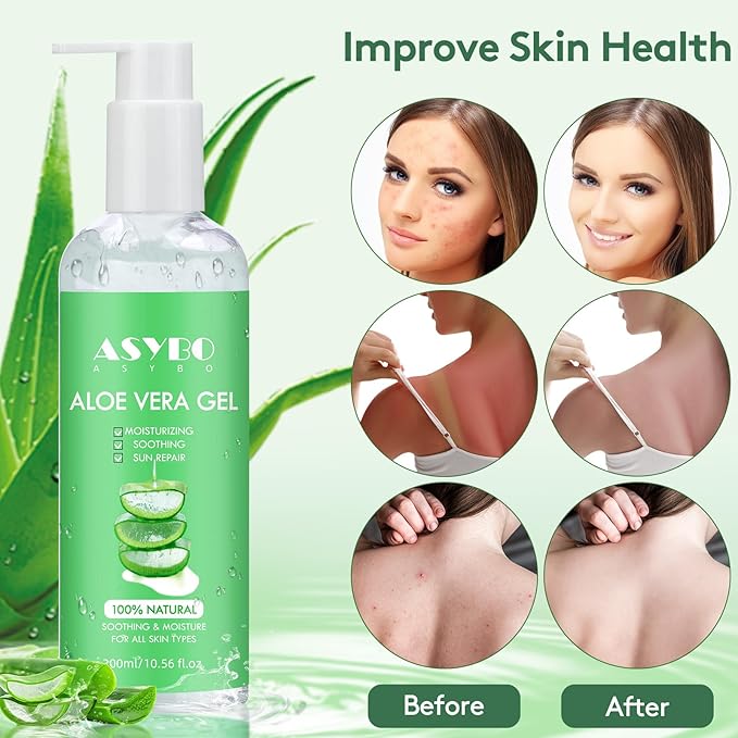 ASYBO 300 ml Aloe Vera Gel, 100% Natural Pure Aloe Vera Hydrating Facial Cream, Soothing & Moisturizing, After Sun Care, Reduce Acne, Repair Scars, Suitable for All Skin Types