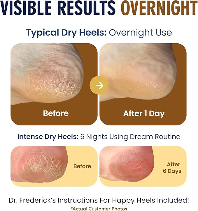 Dr. Frederick's Original Moisturizing Fuzzy Heel Socks for Dry Cracked Heels Treatment - Infused with Olive Oil, Jojoba Oil and Vitamin E - 2 Pairs - Stocking Stuffers for Adults - Citrus Glow