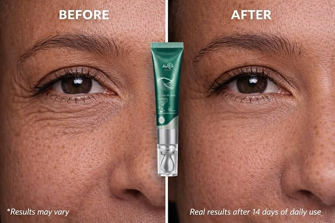 Lifting Power Eye Fluid - Rejuvenating Anti Aging Serum - Hydrating Eye Wrinkle Cream for Women with 5 Peptides & Vitamins - Ceramide, Hyaluronic Acid, Vitamin C, Palmitoyl Tripeptide-1-15ml