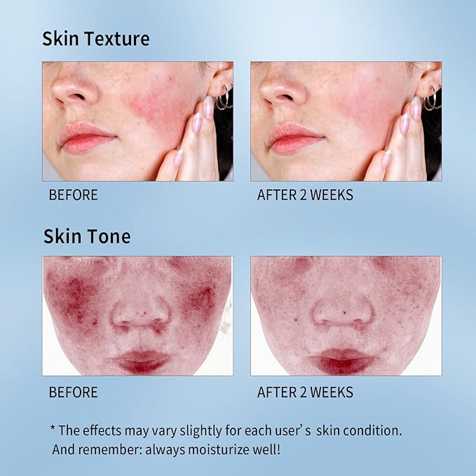 RAZUYEN Soothing Face Sheet Mask (10 Sheets), Anti-Aging, Detoxifying & Moisturizing Face Mask for Sensitive Skin with Centella Asiatica, Vitamin B5, Glass Skin Face Mask for after Microneedling