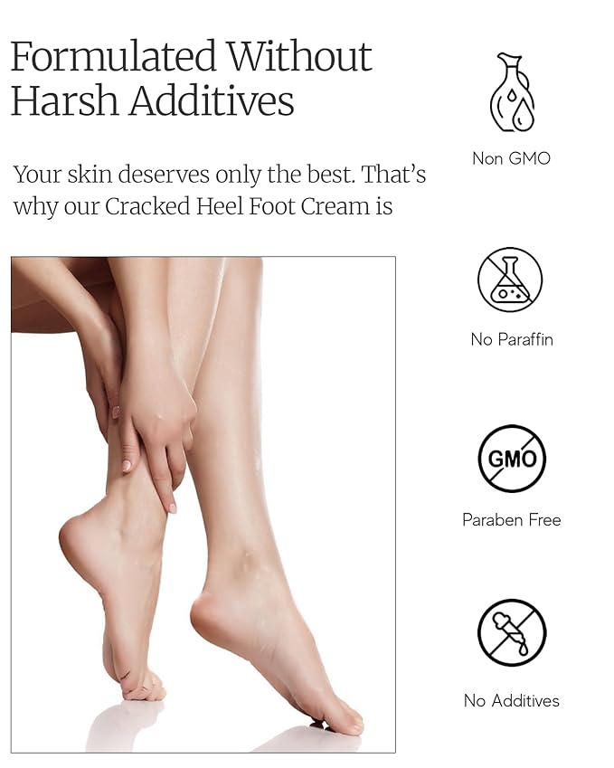 AEOLIS 10% Urea Foot Cream for Cracked Heels (2.03 fl oz), Beeswax, Shea Butter, Aloe Vera & Vitamin E – Deep Moisturizing Care for Rough Feet – Dry Heels Treatment & Softening Foot Cream