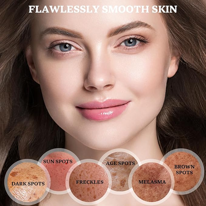 Dark Spot Remover for Face and Body: Dark Spot Corrector Cream, Melasma, Freckle, Sun Spot, Age Spot Remover with Niacinamide and Vitamin C - 1.7 Fl Oz