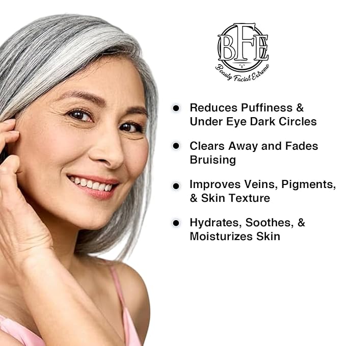 Vitamin K Cream- Moisturizing Bruise Healing Formula. Dark Spot Corrector for Bruising, Spider Veins & Broken Capillaries. Reduces Under Eye Dark Circles, Fine Lines, Puffiness, & Wrinkles.