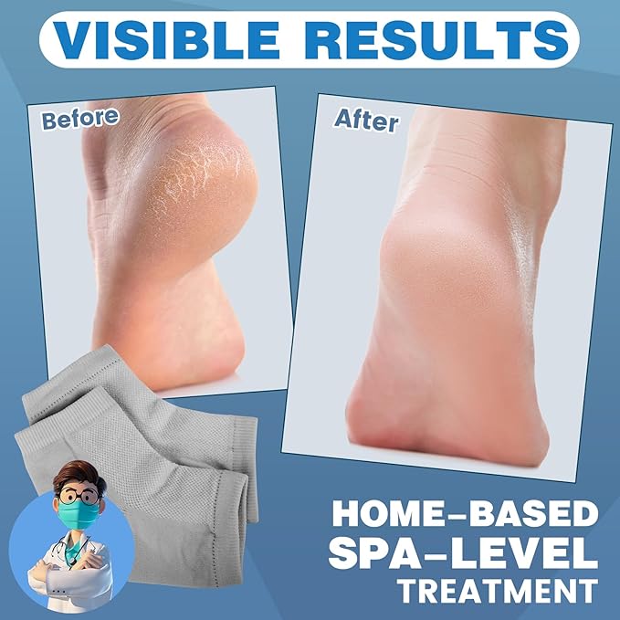 3 Pairs Moisturizing Heel Socks for Cracked Heel Treatment, Foot Care Toeless Socks to Soften and Hydrate Dry Cracked Feet Heels, Cracked Heel Repair Socks, Gel Socks for Dry Cracked Feet