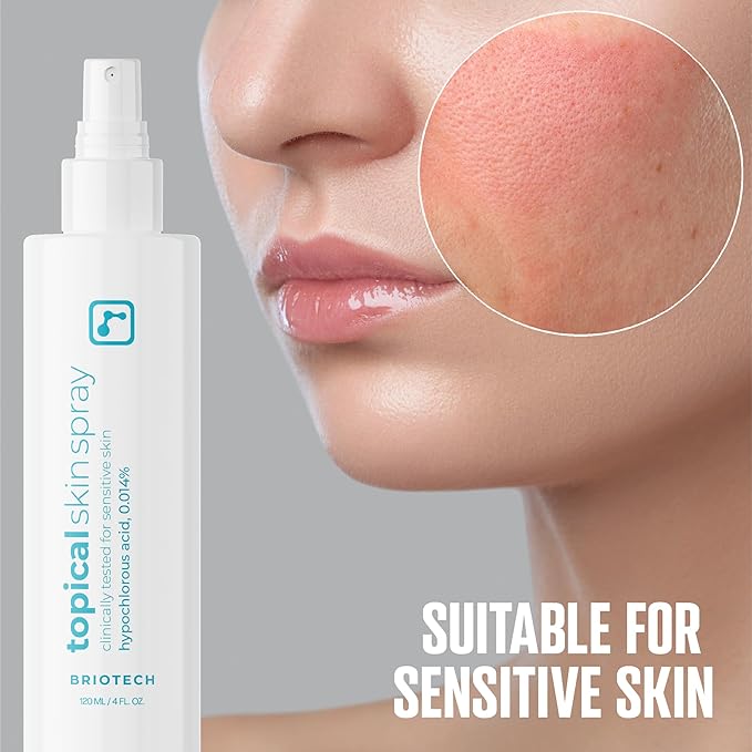 BRIOTECH Topical Skin Spray, Hypochlorous Acid Spray for Body & Face, HOCl Facial Mist, Support Against Irritation, Redness, Packaging May Vary, 4oz (2 Pack)