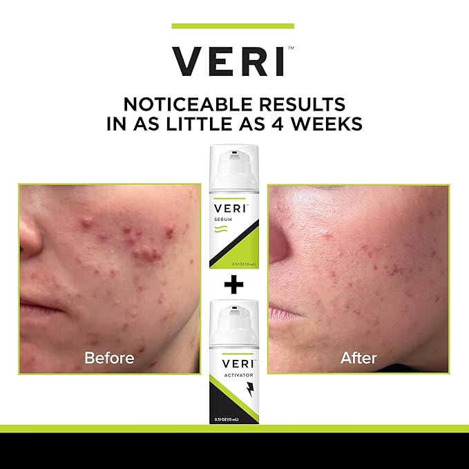 VERI Nitric Oxide + Salicylic Acid mL