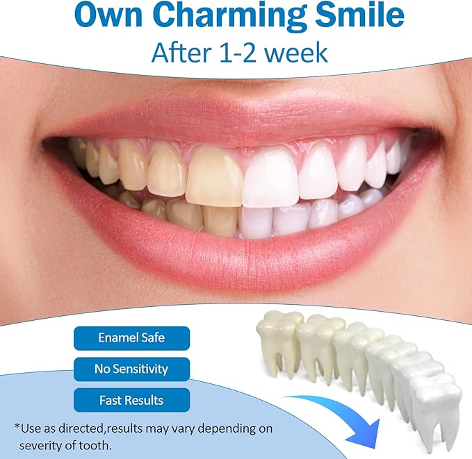 Teeth Whitening Pen - Professionally Stain Removal Teeth Whitening Gel Formula, No Sensitivity Effective Teeth Whitener, Mint (0.11 Fl Oz (Pack of 4))