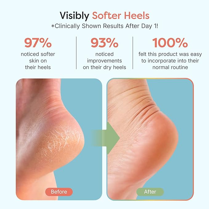 ZenToes Moisturizing Socks for Cracked Heel Treatment, Vitamin E, Olive Oil and Jojoba Oil Infused Heel Socks, Galentines Day Gifts, Self Care Gifts for Women (Fuzzy Blue, Wide Width)