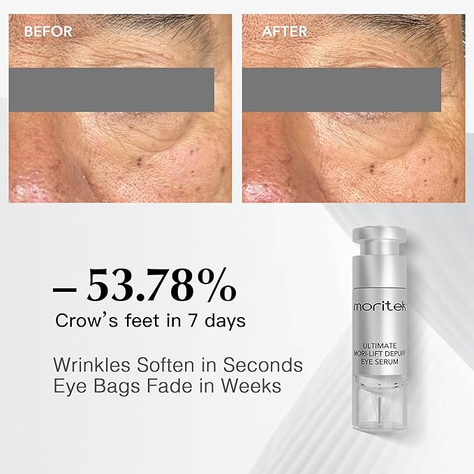 MORITEK Deep Anti-Aging Wrinkle Remover & Eye Serum instantly reduces the appearance of under-eye bags, puffiness, dark circles, wrinkles, fine lines, and crow's feet