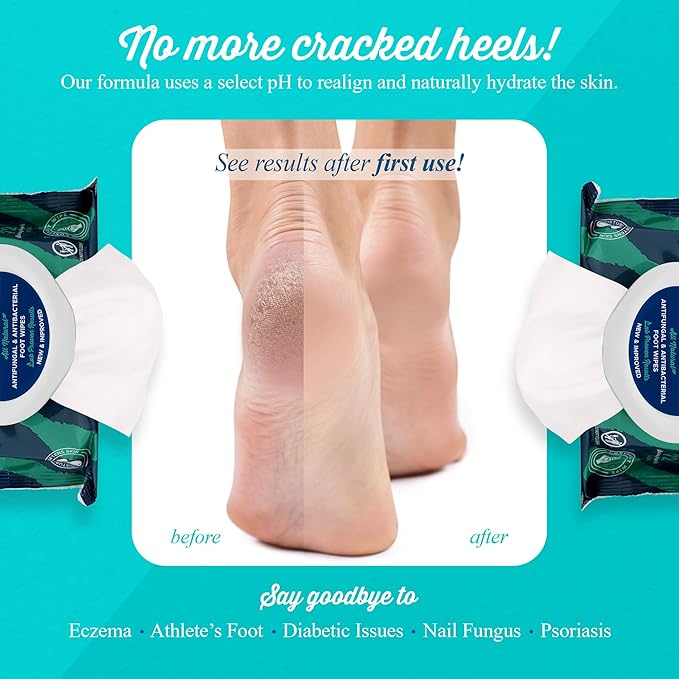 pHeet® Foot Wipes All-Natural Antifungal & Antibacterial Formula, Cleanses, Moisturizes, Prevents & Kills Athletes Foot, Toenail & Foot Fungus, Odor & Improves Dry, Cracked, Flaky & Diabetic Skin 72ct