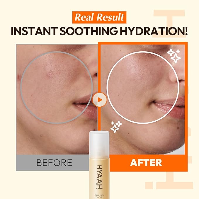 HYAAH All-Day Essential Water - Korean Face Mist Spray - Hydrating Soothing with Chamomile Extract and Houttuynia Cordata - Moisturizing, Calming, Pore Care Daily Skincare, 3.38oz