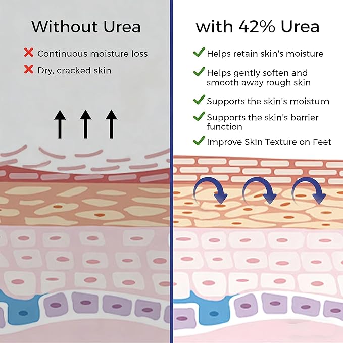 OUKEYA Urea Cream 42% Plus 2% Salicylic Acid, For Extremely Dry Skin on Heels, Elbows, Knees, 5.29 Ounce (Pack of 2)