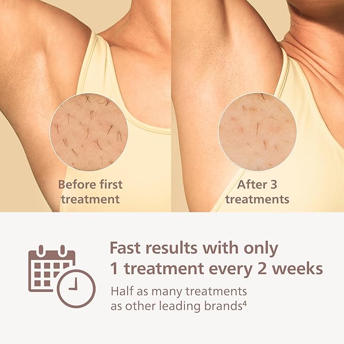 Philips Lumea 8000 Series IPL Hair Removal Device, Personal Permanent at Home Laser Hair Reduction, for Women & Men, SenseIQ Technology, 2 Attachments for Body & Face, BRI932/03