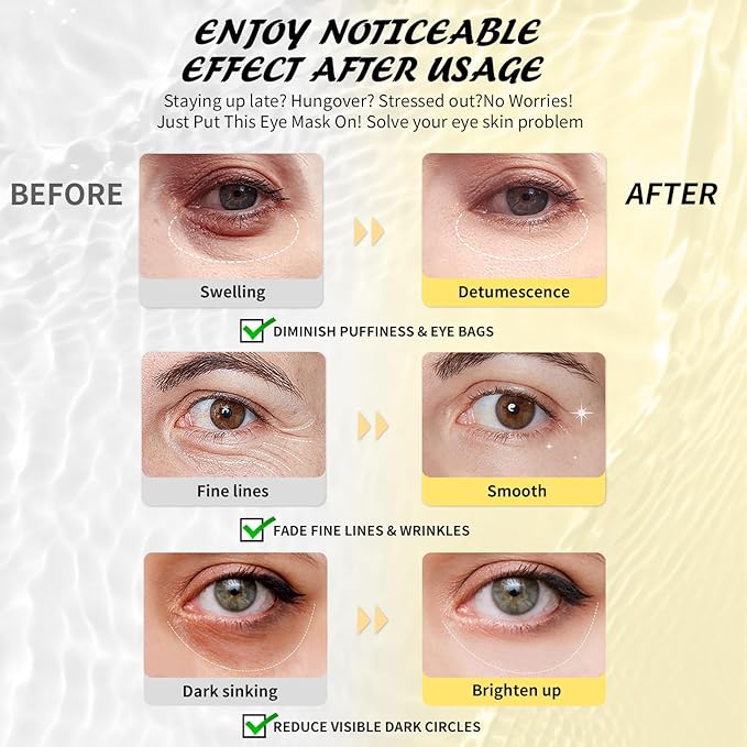 Maskiss Under Eye Patches (50 Pairs), Caffeine Eye Masks for Dark Circles Puffy Eyes Undereye Bags, Collagen Eye Patches for Wrinkles and Puffiness, Skin Care Gift for Her