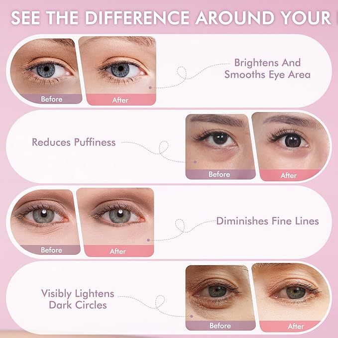 AzLucaky Under Eyes Patches, 40 Pairs Rose Hydrogel Eye Mask for Puffy Eyes and Dark Circles with Rose Essence, Hyaluronic Acid & Niacinamide, Deep Hydrating Eye Treatment for Men & Women