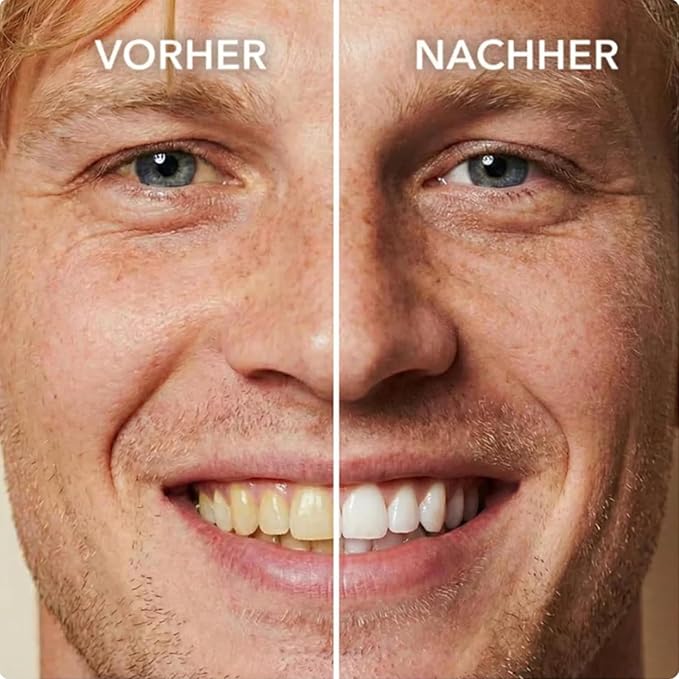 2PCS SmileFitPro Tooth Polish Teeth Whitening Polish Cosmetic Tooth Polishing Liquid for Improving Tooth Appearance, Gentle & Safe Form, Safe Formula & Long-Lasting Results