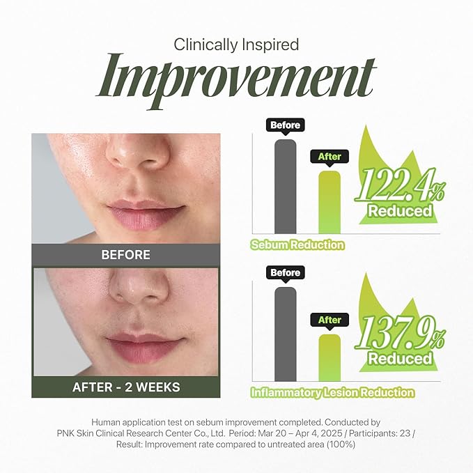 EIOM Trouble Patch Mask | Full-Face Acne Sheet Mask for Acne-Prone & Oily Skin – Blemish & Sebum Control Mask with Tea Tree Biome | Korean Skincare, 20ml x 4