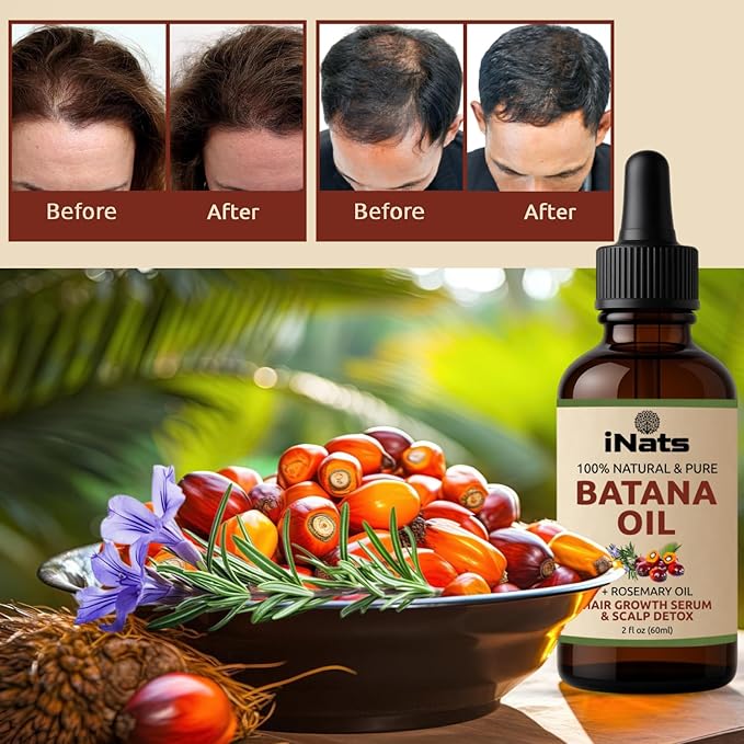 Batana & Rosemary Hair Growth Serum (2 Fl Oz) - Nourish & Detox Scalp for Thicker, Stronger, Longer - Dr. Sebi Recommended, Natural Hair Oil for Women & Men – Intensive Repair & Nourishing