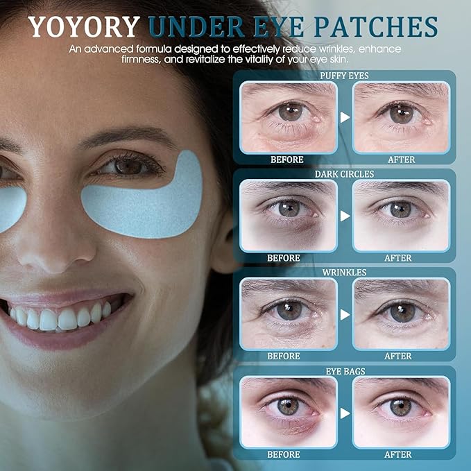 YOYORY Under Eye Patches Masks - for Fine Lines with Collagen and Hyaluronic Acid, Dark Circles,and Fade Wrinkles, puffiness Smoothing Skin Care Treatment for Women and Men, (30 Pcs) white