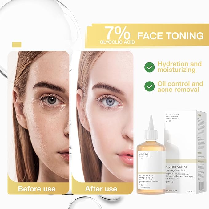 Glycolic Acid 7% Exfoliating Toner: Toner Keep Skin Skin Blemishes 100ml
