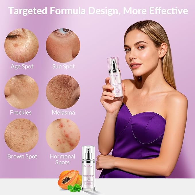Dark Spot Remover for Face and Body, Dark Spot Corrector for Melasma, Acne Scars, Sun Spots and Age Spots, Hyperpigmentation Treatment Vitamin C Dark Spot Correcting Glow Serum, 1.0 fl oz