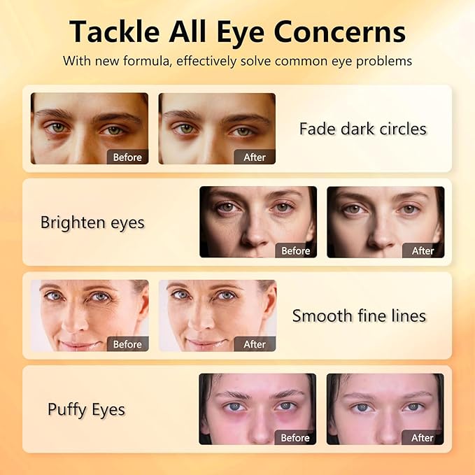 Aeryea Under Eye Patches with Vitamin C & Caffeine 30 Pairs for Dark Circles, Fine Lines and Puffiness, with Niacinamide Hydra-Gel Collagen, Skin Care for Men & Women