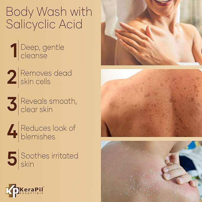 KERAPIL Exfoliating Body Wash with Salicylic Acid - No Dry Out, Gentle Exfoliates Rough and Bumpy Skin, Body Acne Wash, BHA & AHA - Coconut and Vanilla Salicylic Acid Body Wash - (16 fl oz x 2)