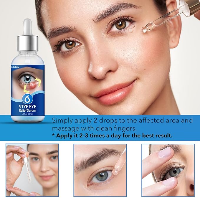 Stye Eye Drops, Stye Eye Treatment, Eye Stye Relief Serum, Non-Irritating Formula with Hippophae Rhamnoides Fruit Oil & Avo-cado Oil, Target Chalazions & Blepharitis (1 Fl. OZ)