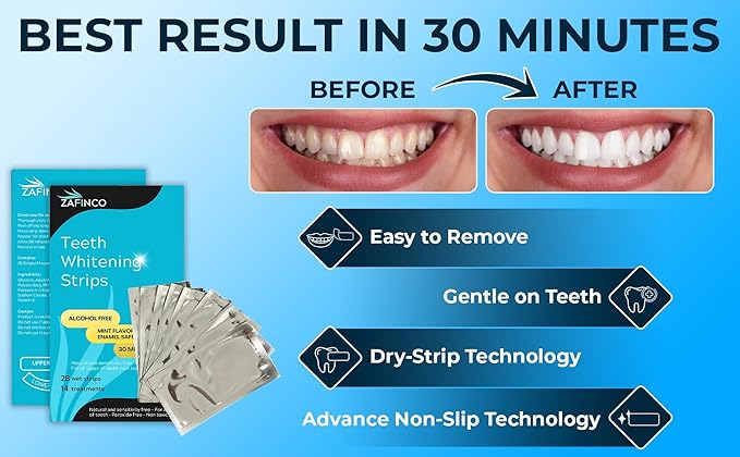 Teeth Whitening Strips for a Brighter Smile - 28 Mint Flavored Sensitive Teeth Whitening Strips, Dentist Recommended,-Non Toxic, Peroxide Free & Enamel Safe - 14 Treatments, Made in USA