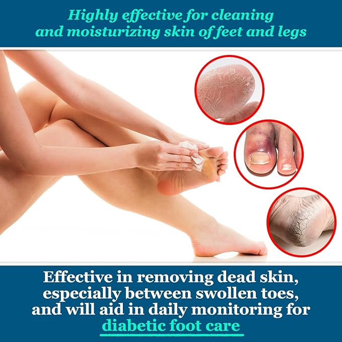 pHeet® Foot Wipes All-Natural Antifungal & Antibacterial Formula, Cleanses, Moisturizes, Prevents & Kills Athletes Foot, Toenail & Foot Fungus, Odor & Improves Dry, Cracked, Flaky & Diabetic Skin 72ct