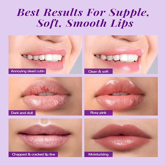 ANAI RUI Lip Therapy Set, Lip