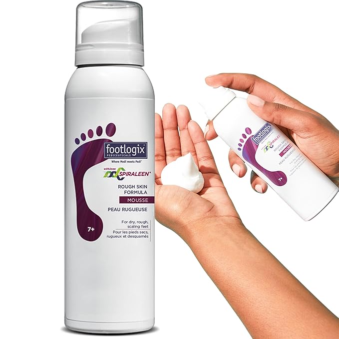 Footlogix Rough Skin Formula with Spiraleen - Mousse for Dry Cracked Heels and Feet, Foot Care for Men and Women, Dry Cracked Feet Treatment, 4.23oz