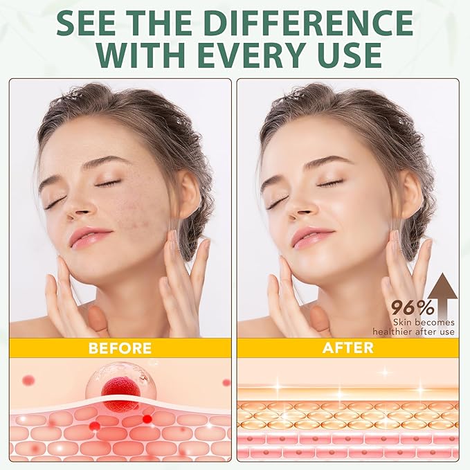 Beef Tallow for Skin, Beef Tallow Moisturizer, 8.4 oz Organic Whipped Grass Fed Beef Tallow with Honey Cream for Face & Body, Unscented