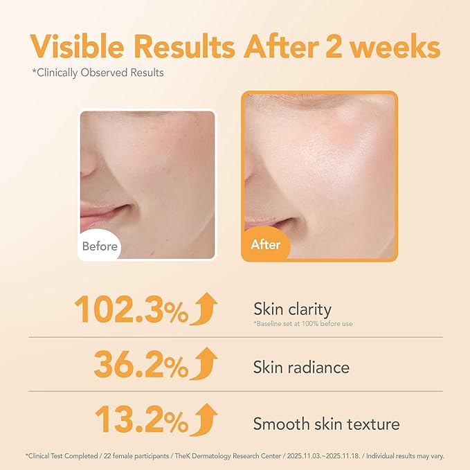 BALOOM 10% Niacinamide Dark Spot Remover For Face – Korean Skin Care for Uneven Tone, Discoloration & Pore Minimizing – Brightening Glutathione Face Serum for Hydration & Glass Skin – 1.69 fl oz