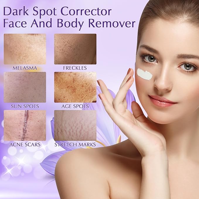 Dark Spot Remover for Face and Body, Dark Spot Corrector, Rapid Tone Repair Retinol Cream, Melasma Treatment with Vitamin C, Upgraded Skin Care Cream for Women Men
